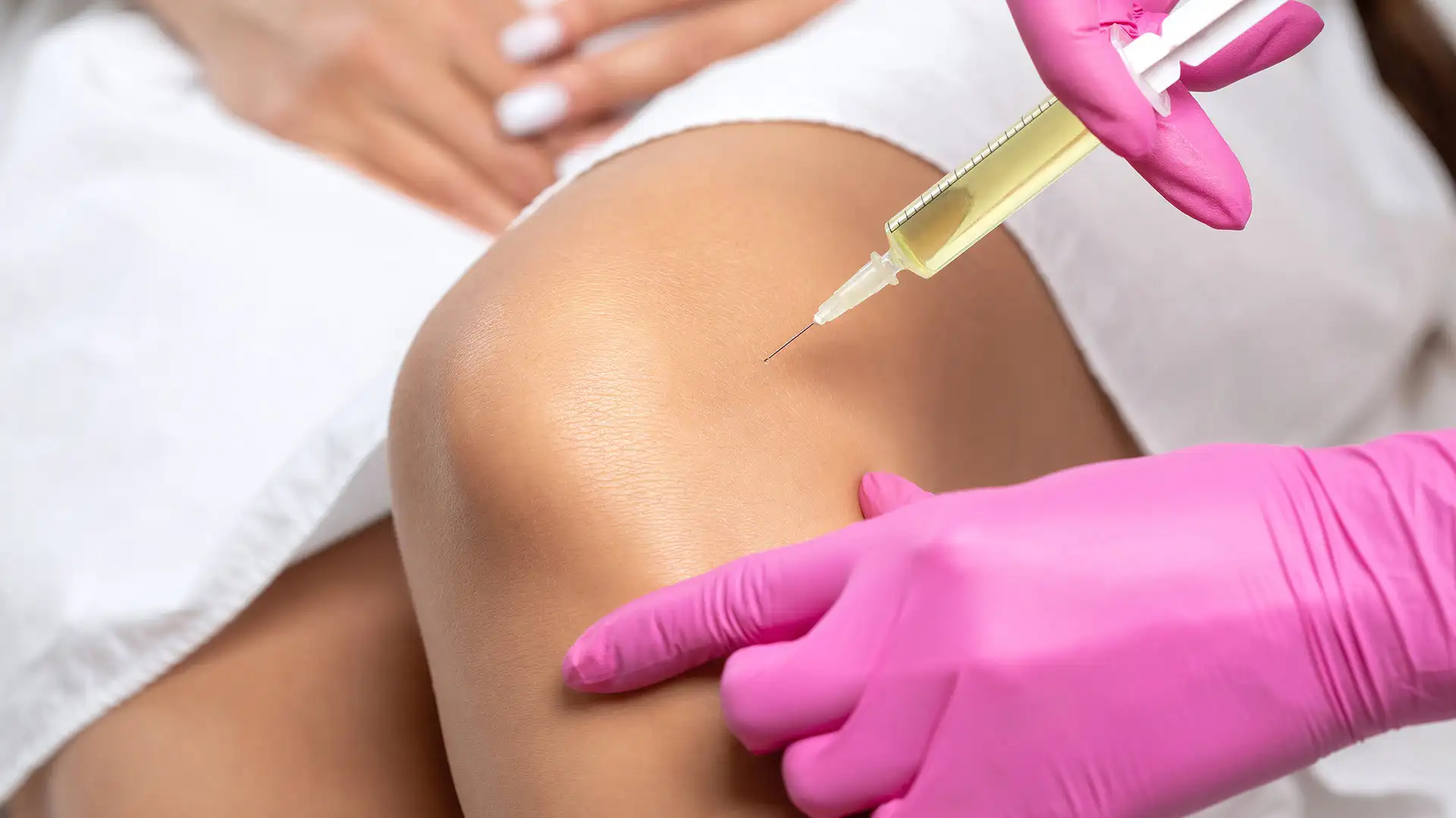 PRP / Stem Cell Injections treatment at Boca Medical Aesthetics in Boca Raton